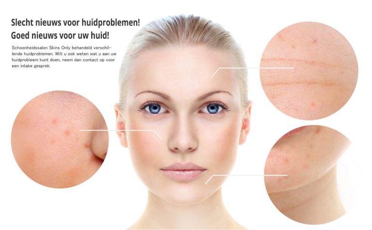 Ik wil van mijn huidprobleem af. - Huidinstituut Skins Only